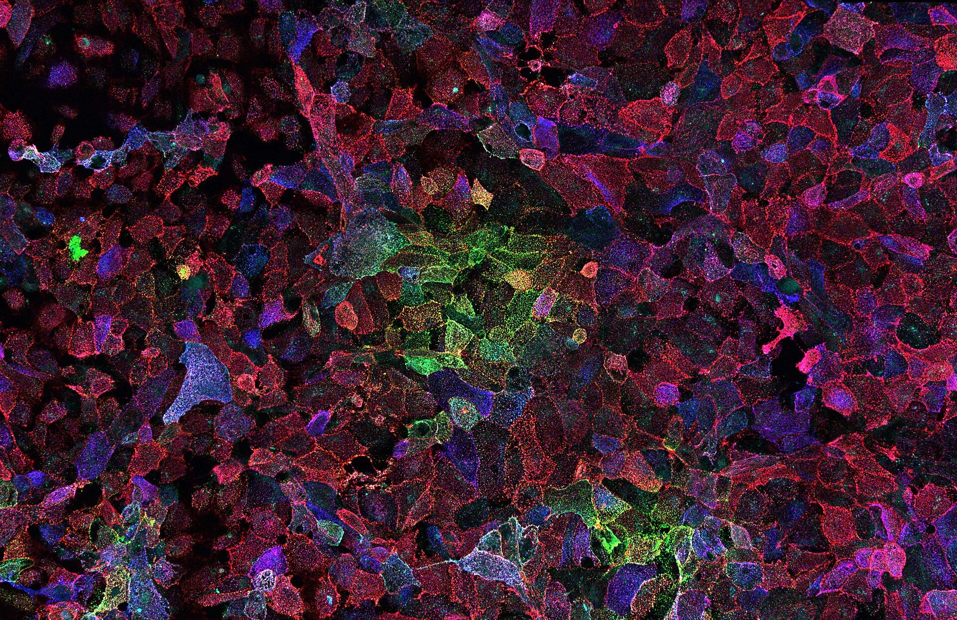Fluorescence microscopy in red and blue